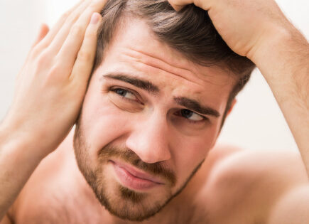 Hombre con alopecia