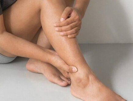 mala circulación de piernas