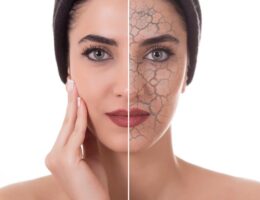 Rostro de mujer maltratado