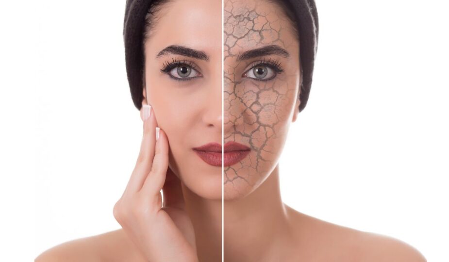 Rostro de mujer maltratado